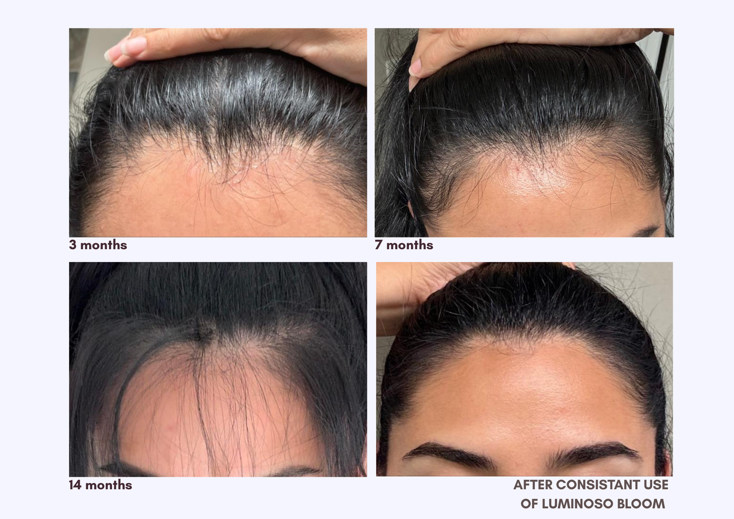 Back to Your Roots TLC – Nourishing Pre-Wash Scalp Oil